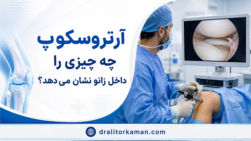 آرتروسکوپی زانو