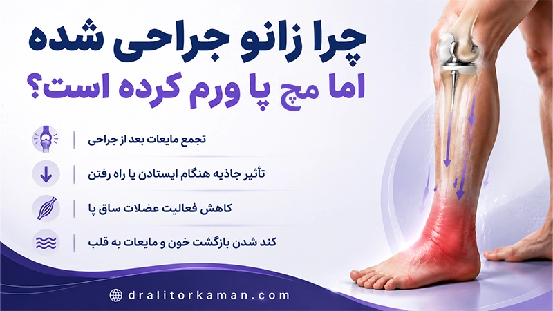 چرا زانو جراحی شده اما مچ پا ورم کرده است؟