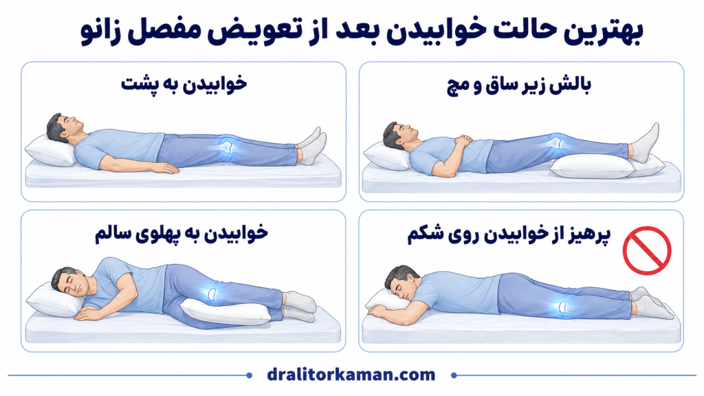 بهترین حالت خوابیدن بعد از تعوضمفصل زانو
