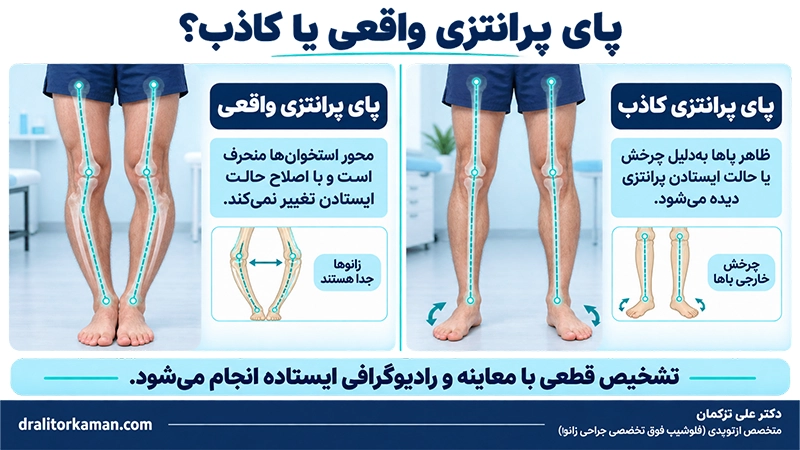 تست پای پرانتزی در خانه را چگونه درست انجام دهیم