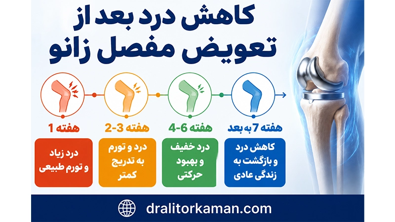 کاهش درد بعد از تعویض مفصل زانو