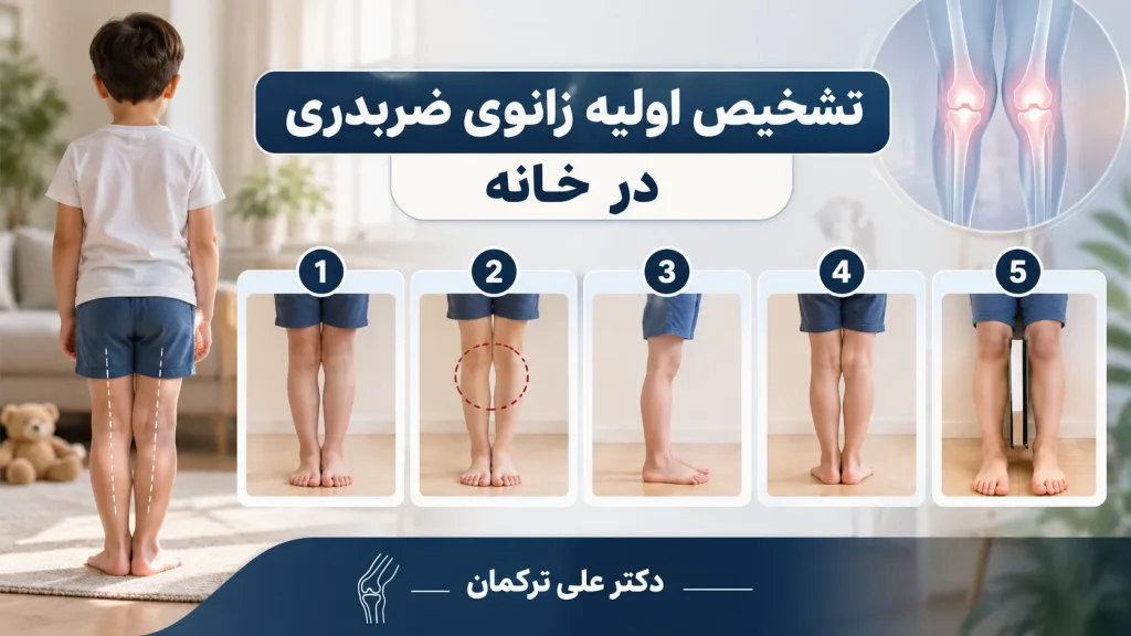 بررسی زانو ضربدری در خانه