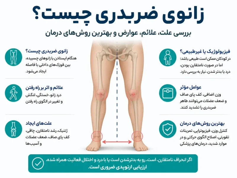 زانوی ضربدری چیست؛ بررسی علت، علائم، عوارض و بهترین روشهای درمان
