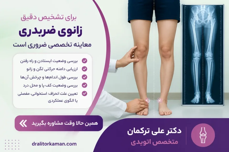 نحوه تشخیص زانوی ضربدری چگونه است — ارزیابی محور اندام و عکس ایستاده تمامقد برای تشخیص زانوی ضربدری