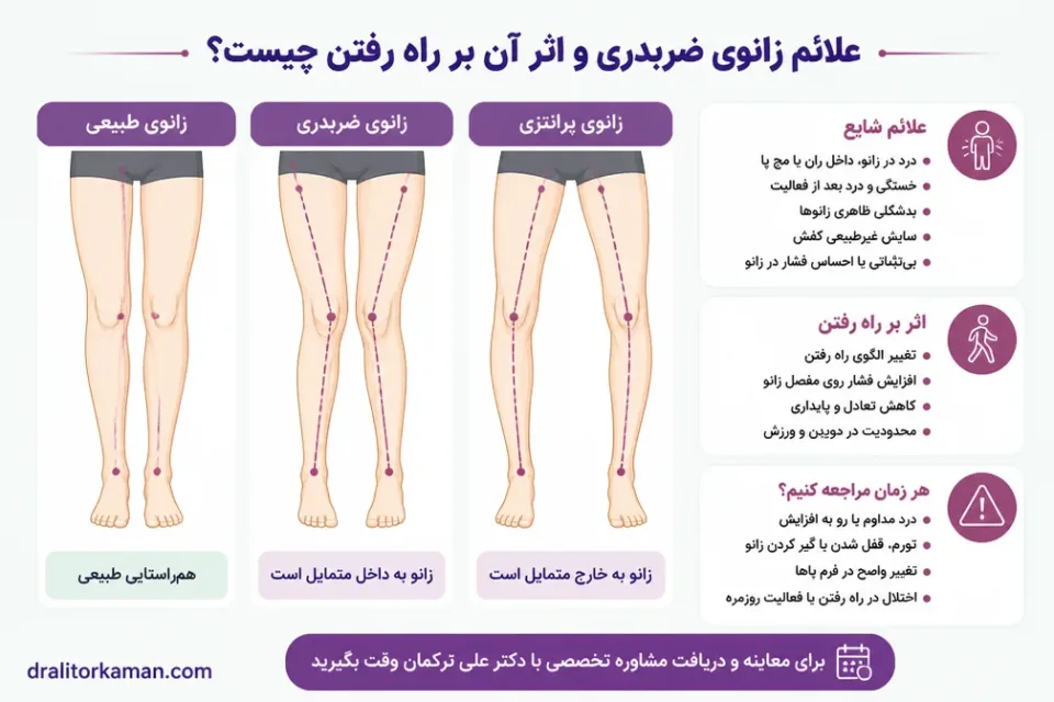 علائم زانوی ضربدری و اثر آن بر راه رفتن چیست — مقایسه محور طبیعی زانو با زانوی ضربدری و پای پرانتزی